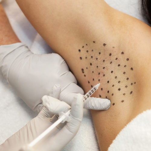 ботокс алматы