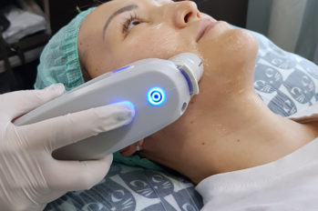 смас лифтинг