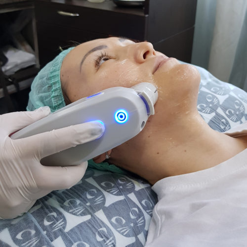 смас лифтинг