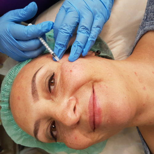 ботокс алматы