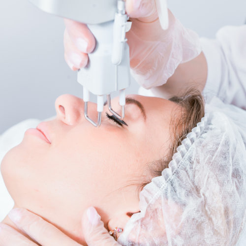 лазерная шлифовка