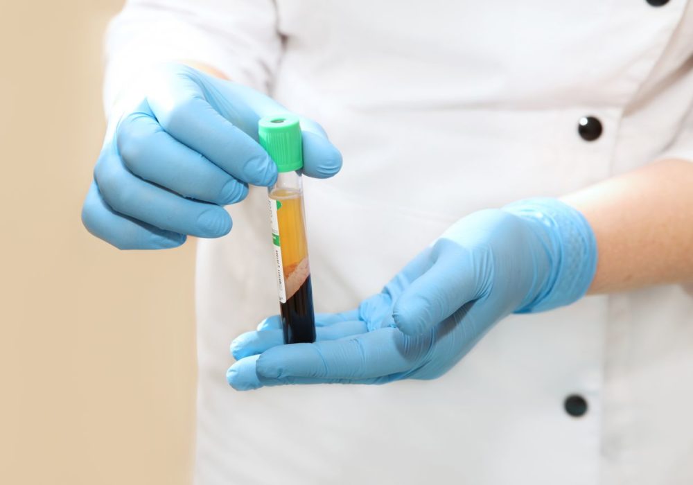 плазмолифтинг